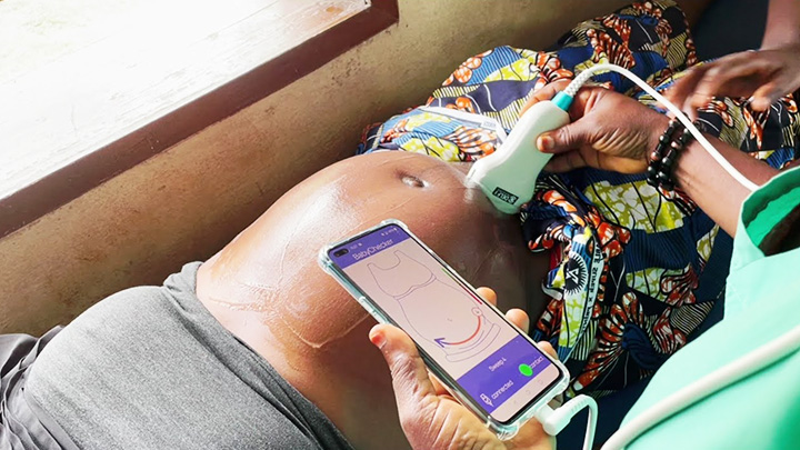 Babychecker how it works