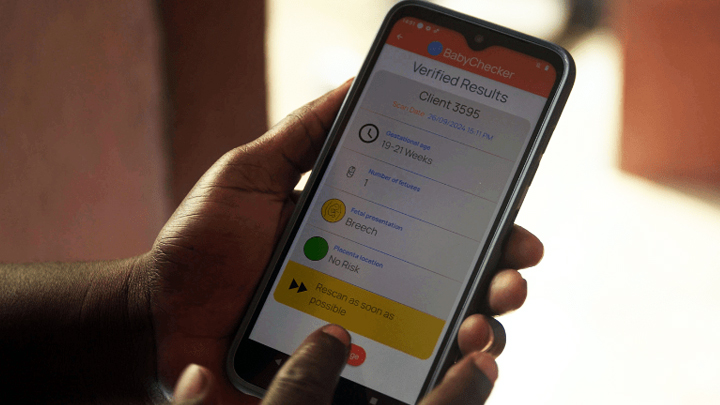 Babychecker how it works